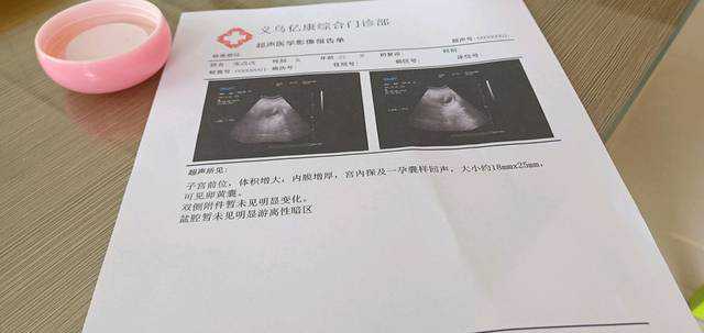 郑州代生产子费用，郑州女性做试管婴儿的费用是多少呢