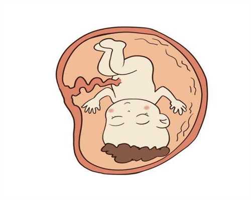 广州代孕包生儿子费用多少-检查得了卵巢癌到底怎么治