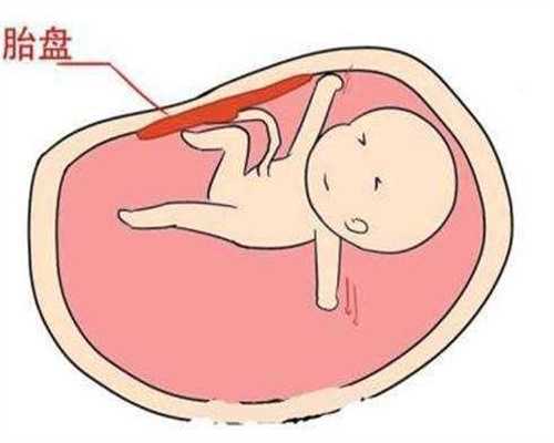 爱心代孕,卵巢囊肿会影响生育吗,广州有代孕生孩子的吗
