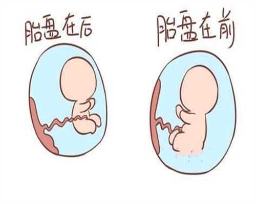北京输卵管结扎部位_北京代孕中介广州