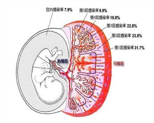 广州试管代孕附睾_广州试管代孕价目表_遇到输卵管问题我们该如何选择？
